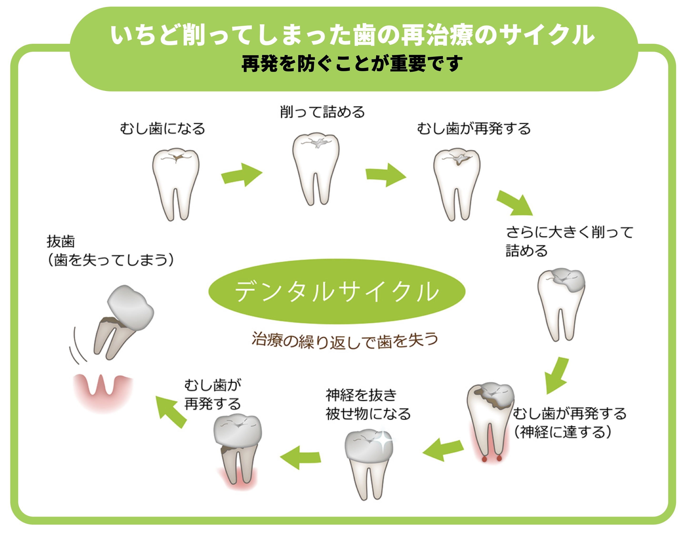 メンテナンスのご案内（カリエス）2
