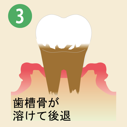 7-4