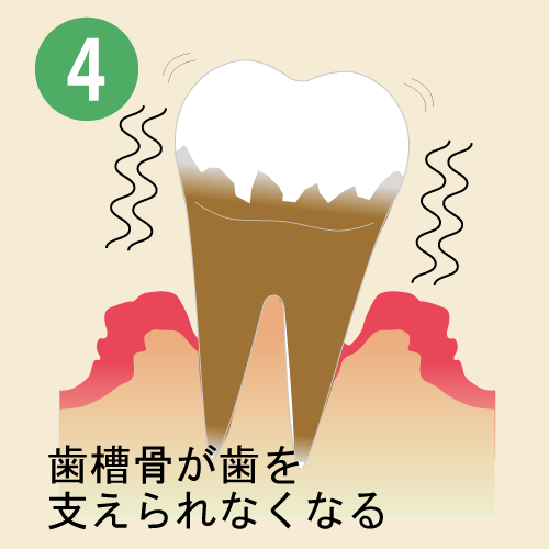7-5
