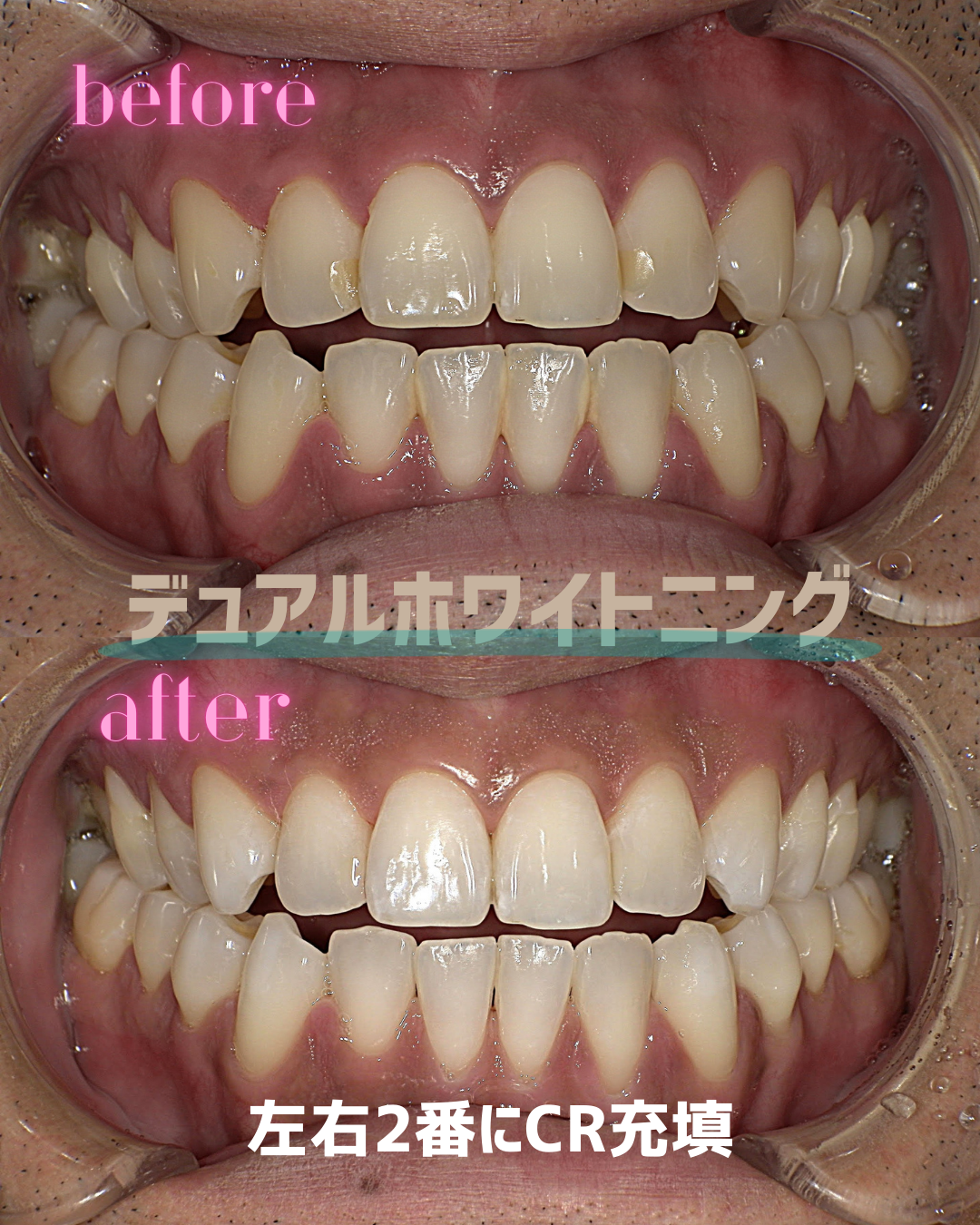 名称未設定 (Instagramの投稿（45）)