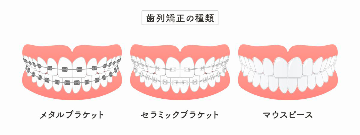 矯正装置