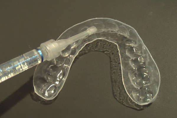 11-2_ホームホワイトニング