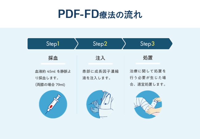 PFD療法の流れ