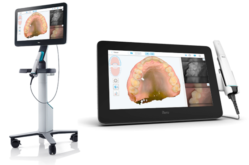 iTero Lumina Pro