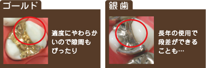 ゴールドなら隙間もピッタリ！