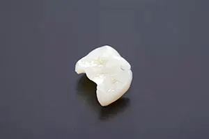 セラミック・ジルコニア