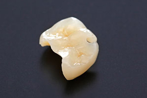 プラスチック・CADCAM