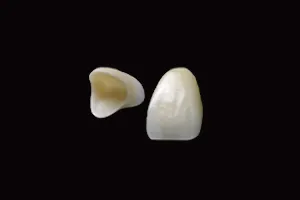 セラミック・ジルコニア