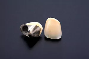 プラスチック・CADCAM