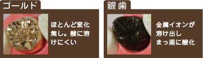 ゴールドは酸に溶けにくい金属です