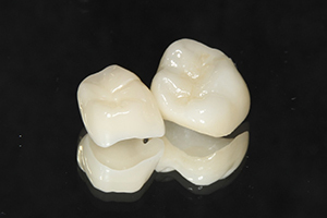 セラミック・ジルコニア