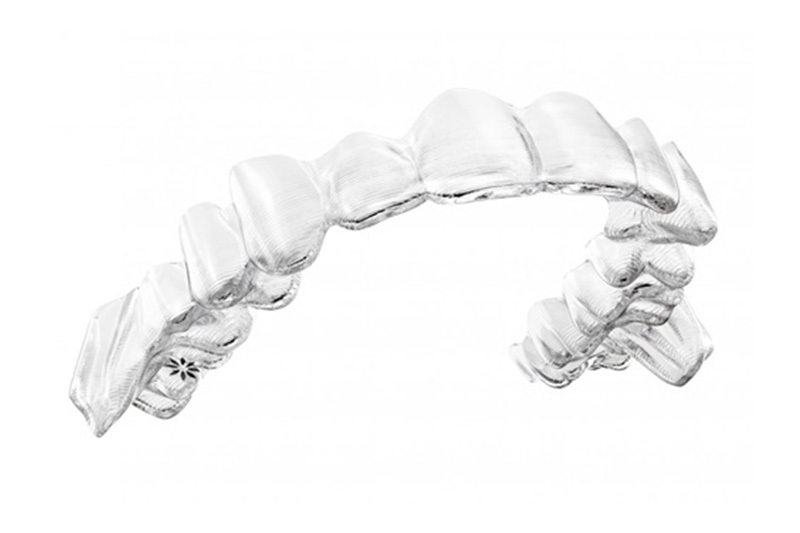 img_orthodontics_igo02