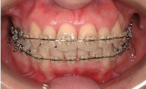 adult_img002_コピー_コピー