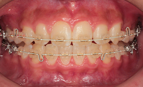 01白いワイヤー_コピー_コピー