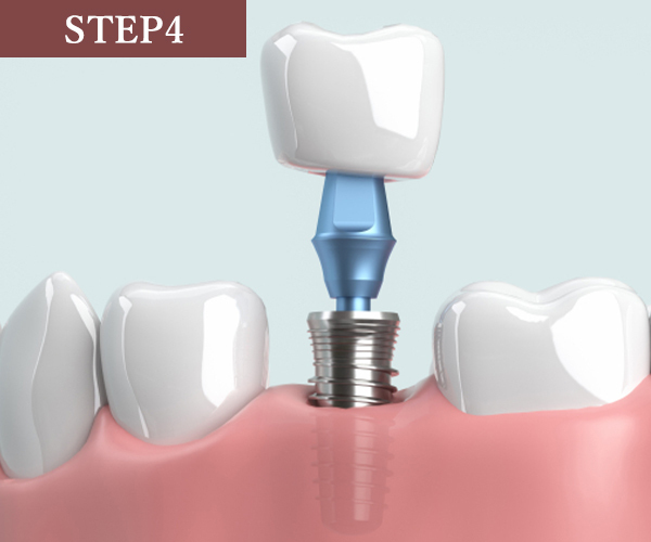 step04