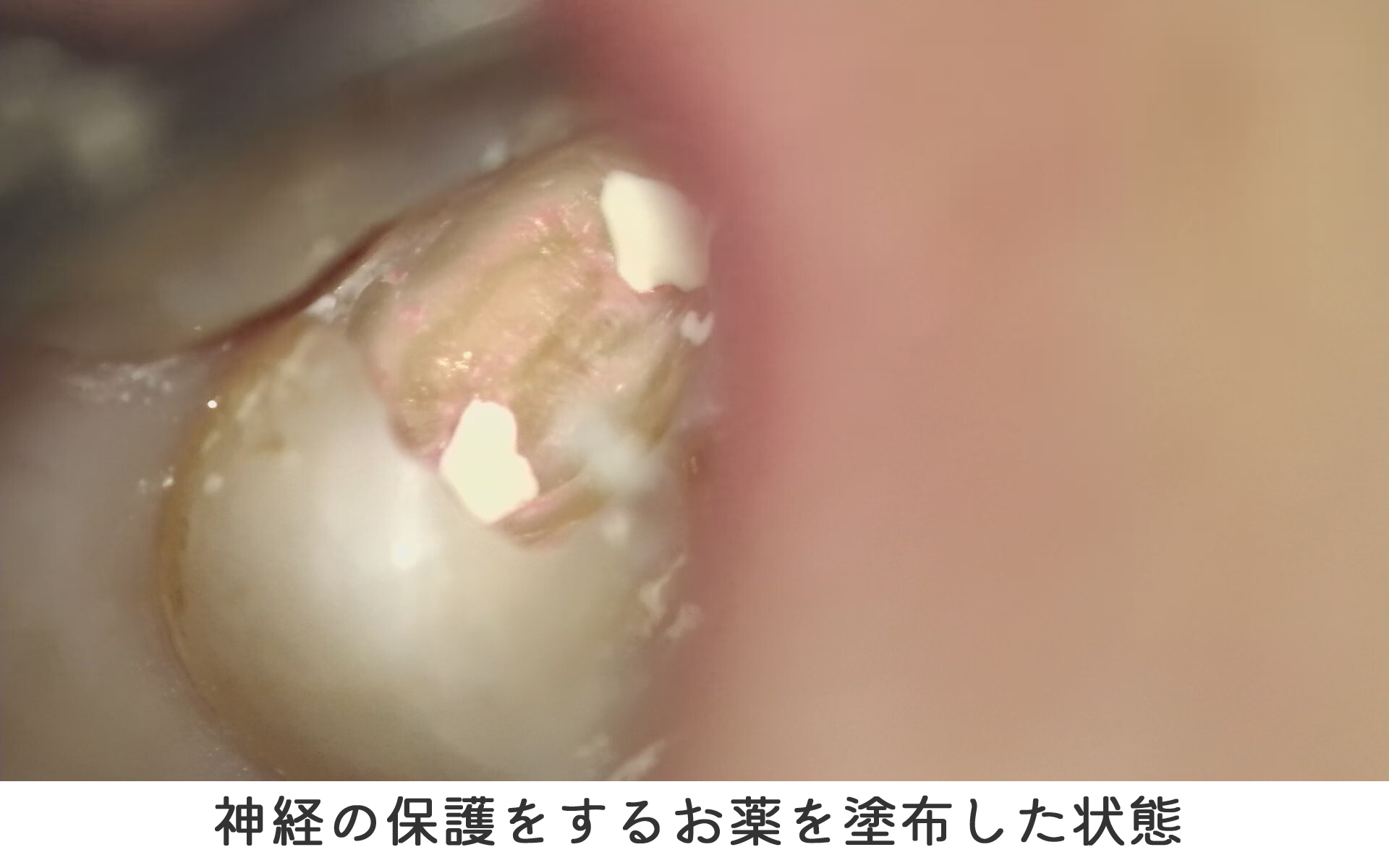 01-2