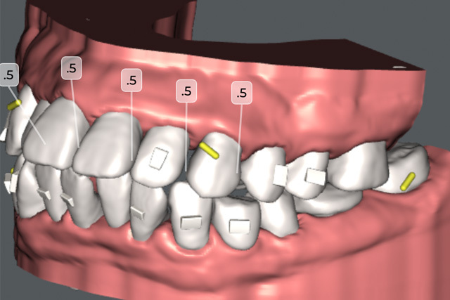 img_orthodontics01