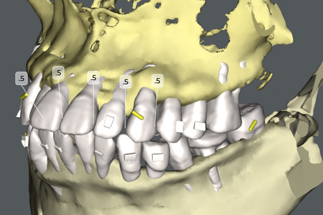 img_orthodontics02
