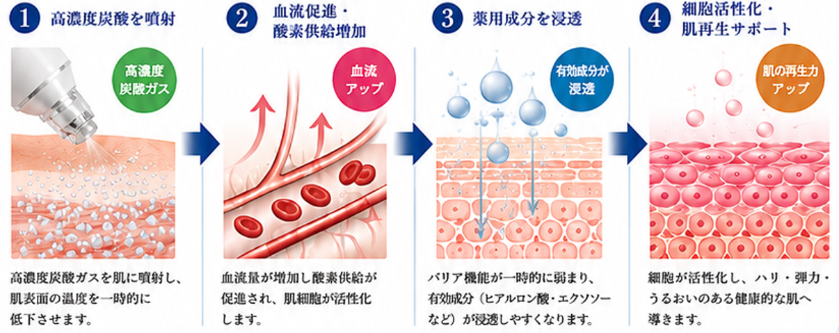 15-3
